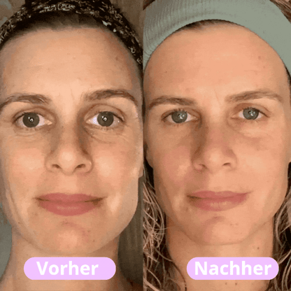 Bairic - Straffendes LED-Gesichtsmassagegerät